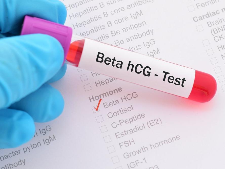 Hamilelik Testi